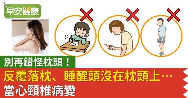 別再錯怪枕頭！反覆落枕、睡醒頭沒在枕頭上…當心已是頸椎病變警訊