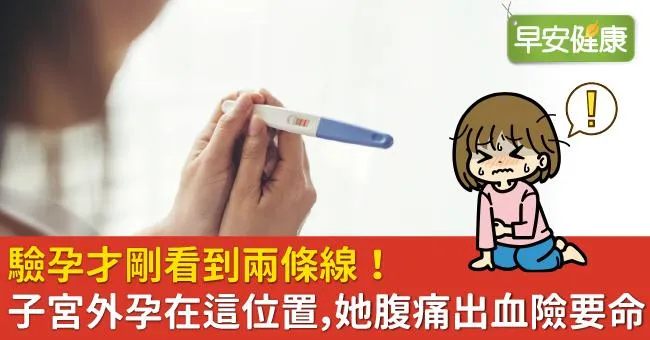 驗孕才剛看到兩條線，子宮外孕在這位置，她腹痛出血險要命