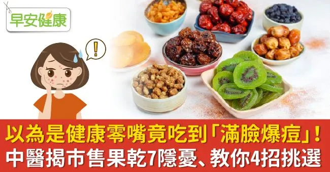 以為是健康零嘴竟吃到「滿臉爆痘」！中醫揭市售果乾7隱憂、教你4招挑選