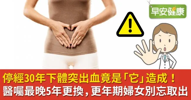 停經30年下體突出血竟是「它」造成！醫囑最晚5年更換，更年期婦女別忘取出