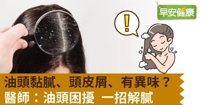 油頭黏膩、頭皮屑、有異味？醫師：油頭困擾 一招解膩