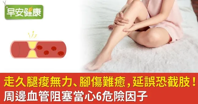 走久腿痠無力、腳傷難癒，延誤恐截肢！周邊血管阻塞當心6危險因子