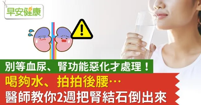 別等血尿、腎功能惡化才處理！喝夠水、拍拍後腰…醫師教你2週把腎結石倒出來