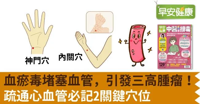 血瘀毒堵塞血管，引發三高腫瘤！疏通心血管必記2關鍵穴位