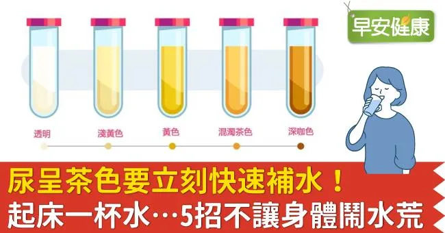 尿呈茶色要立刻快速補水！起床一杯水…5招不讓身體鬧水荒