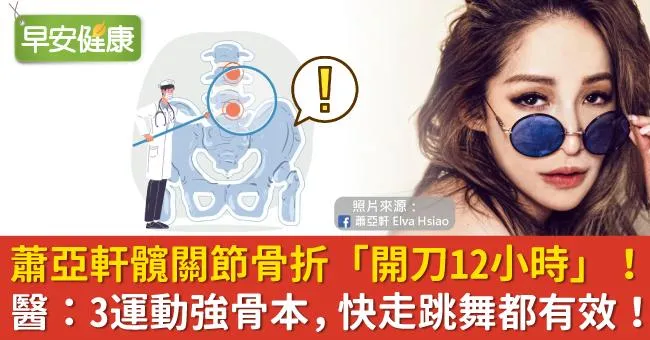 蕭亞軒髖關節骨折「開刀12小時」！醫：3運動強骨本，快走跳舞都有效！