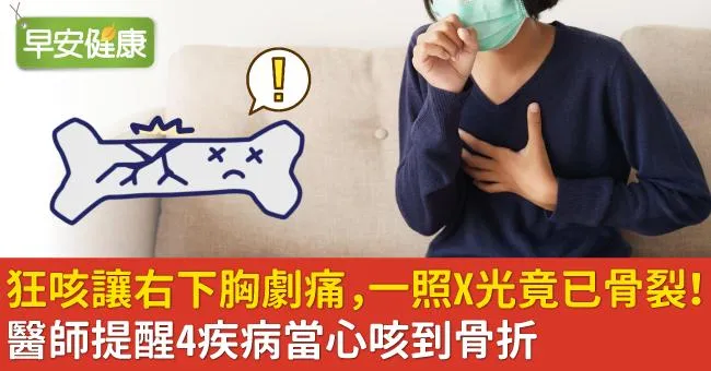 狂咳讓右下胸劇痛，一照X光竟已骨裂！醫師提醒4疾病當心咳到骨折