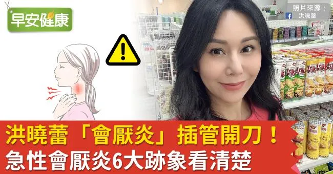 洪曉蕾「會厭炎」插管開刀！急性會厭炎6大跡象看清楚