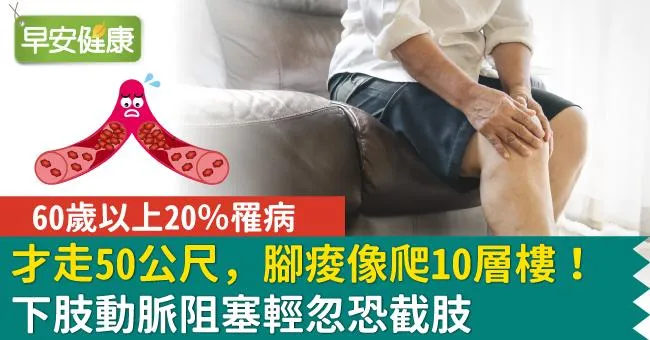 才走50公尺，腳痠像爬10層樓！下肢動脈阻塞輕忽恐截肢