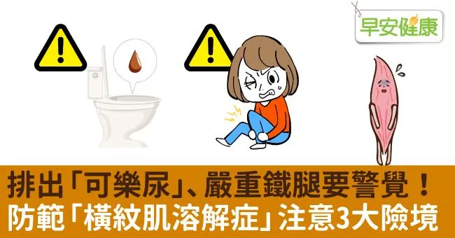 排出「可樂尿」、嚴重鐵腿要警覺！防範「橫紋肌溶解症」注意3大險境