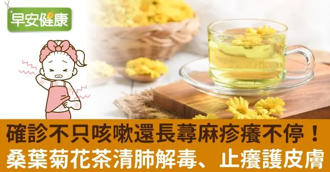 確診不只咳嗽還長蕁麻疹癢不停！桑葉菊花茶清肺解毒、止癢護皮膚