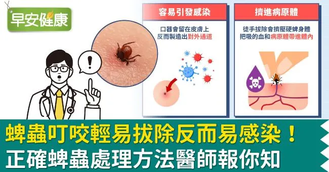 蜱蟲叮咬輕易拔除反而易感染！正確蜱蟲處理方法醫師報你知