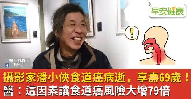 攝影家潘小俠食道癌病逝，享壽69歲！醫：這因素讓食道癌風險大增79倍