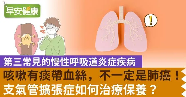 醫師我痰好多—認識支氣管擴張症