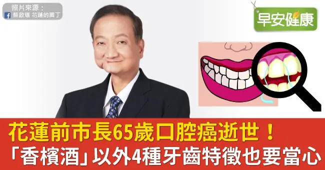 花蓮前市長65歲口腔癌逝世！「香檳酒」以外4種牙齒特徵也要當心