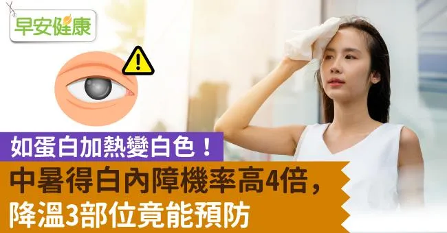 中暑得白內障機率高4倍，如蛋白加熱變白色！降溫3部位竟能預防