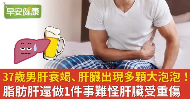 37歲男肝衰竭、肝臟出現多顆大泡泡！脂肪肝還做1件事難怪肝臟受重傷