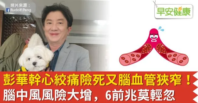 彭華幹心絞痛險猝死，更檢出腦血管狹窄！腦中風風險大增，6前兆莫輕忽
