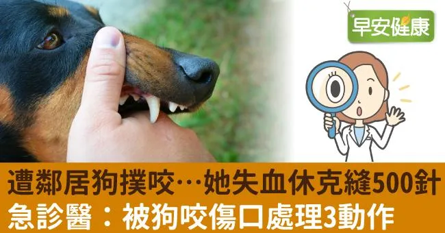 遭鄰居狗撲咬…她失血休克縫500針！急診醫：被狗咬傷口處理3動作