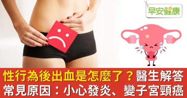性行為後出血是怎麼了？醫生解答常見原因：小心發炎、變子宮頸癌