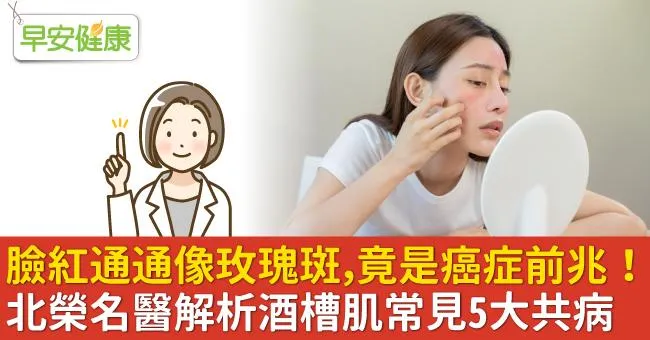 臉紅通通像玫瑰斑，竟是癌症前兆！北榮名醫解析酒槽肌常見5大共病