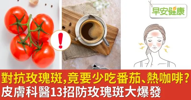 對抗玫瑰斑，竟要少吃番茄、熱咖啡？皮膚科醫13招防玫瑰斑大爆發