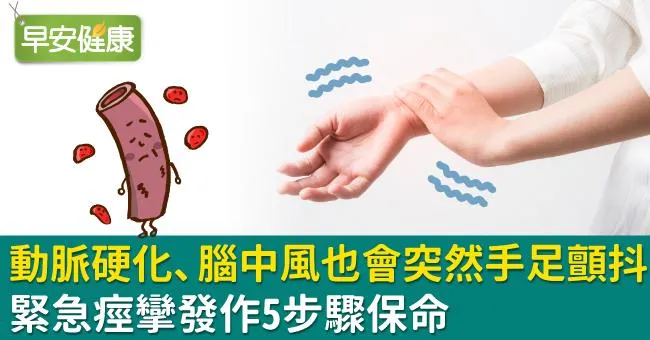 動脈硬化、腦中風也會突然手足顫抖！緊急痙攣發作5步驟保命