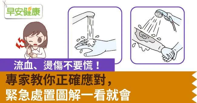 流血、燙傷不要慌！專家教你正確應對，緊急處置圖解一看就會