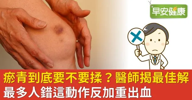 瘀青到底要不要揉？醫師揭最佳解：最多人錯這動作反加重出血