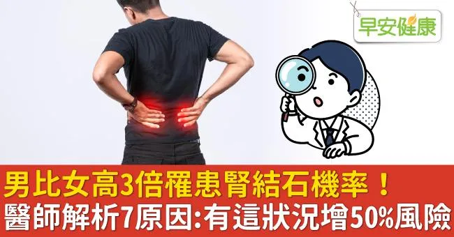 男比女高3倍罹患腎結石機率！醫師解析7原因：有這狀況增50％風險