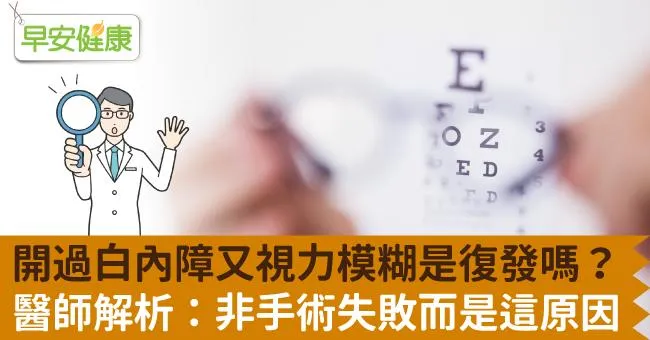 開過白內障又視力模糊是復發嗎？醫師解析：非手術失敗而是這原因