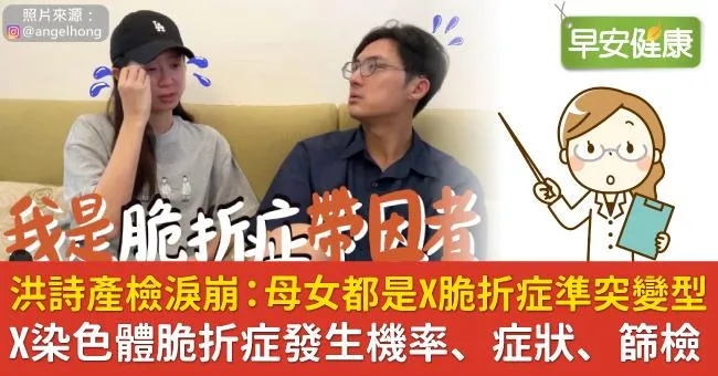 女星洪詩懷孕淚崩：寶寶是X脆折症準突變型！X染色體脆折症發生機率、症狀、篩檢