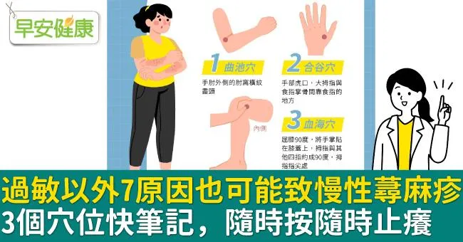 過敏以外7原因也可能致慢性蕁麻疹！3個穴位快筆記，隨時按隨時止癢