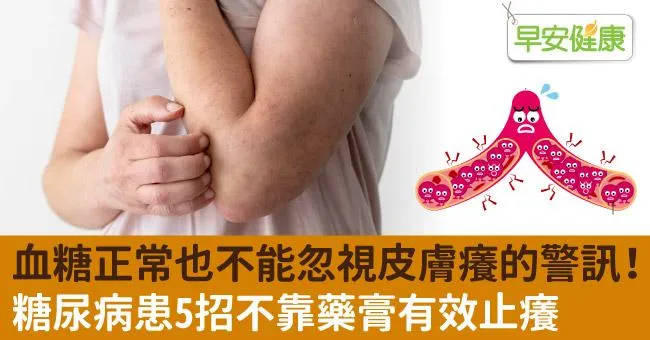 血糖正常也不能忽視皮膚癢的警訊！糖尿病患5招不靠藥膏有效止癢