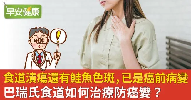 食道潰瘍還有鮭魚色斑，已是癌前病變！巴瑞氏食道如何治療防癌變？