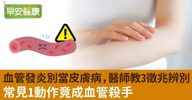 「血管發炎」別當皮膚病，醫師教3徵兆辨別！常見1動作竟成血管殺手