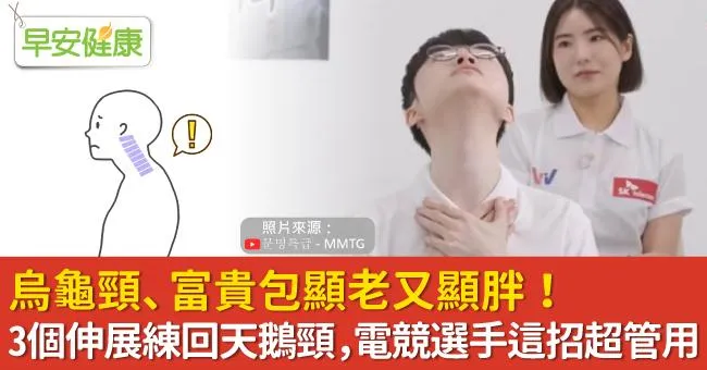 烏龜頸、富貴包顯老又顯胖！3個伸展練回天鵝頸，電競選手這招超管用