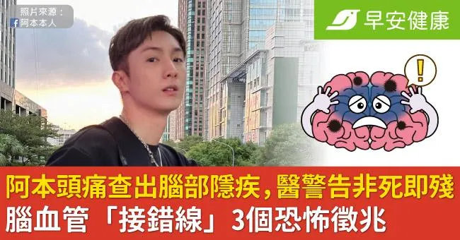 阿本頭痛查出腦部隱疾，醫警告非死即殘！腦血管「接錯線」3個恐怖徵兆