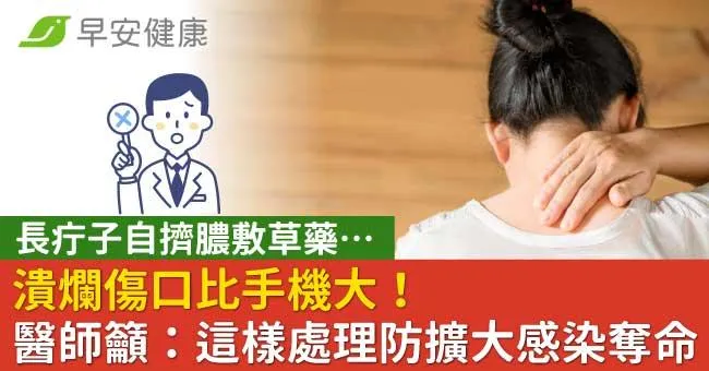 長疔子自擠膿敷草藥…潰爛傷口比手機大！醫師籲：這樣處理防擴大感染奪命