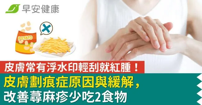 皮膚常有浮水印輕刮就紅腫！皮膚劃痕症原因與緩解，改善蕁麻疹少吃2食物