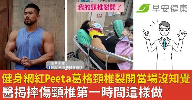健身網紅Peeta葛格頸椎裂開當場沒知覺！醫揭摔傷頸椎第一時間這樣做