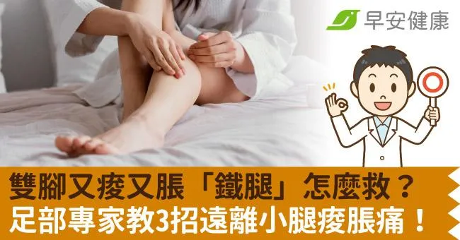雙腳又痠又脹「鐵腿」怎麼救？足部專家教3招遠離小腿痠脹痛！