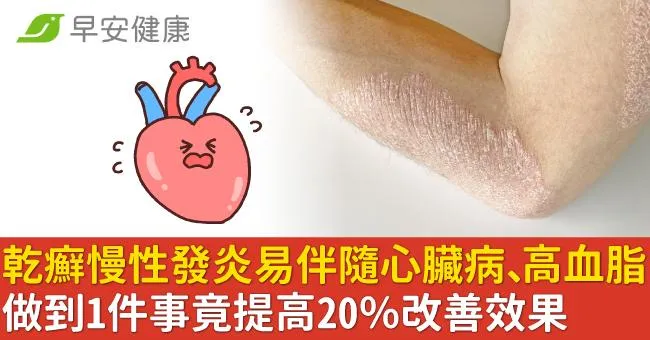 乾癬慢性發炎易伴隨心臟病、高血脂！做到1件事竟提高20％改善效果