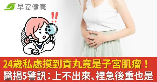 24歲私處摸到貢丸竟是子宮肌瘤！醫揭5警訊：上不出來、裡急後重也是