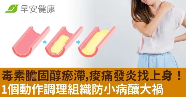 毒素膽固醇瘀滯，痠痛發炎找上身！1個動作調理組織防小病釀大禍