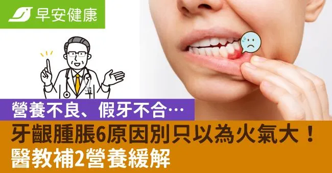 營養不良、假牙不合…牙齦腫脹6原因別只以為火氣大！醫教補2營養緩解