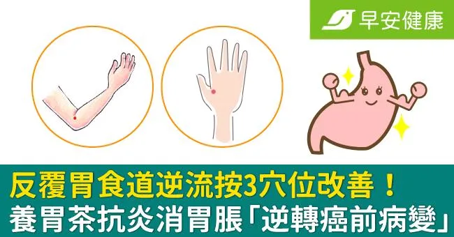 反覆胃食道逆流按3穴位改善！養胃茶抗炎消胃脹「逆轉癌前病變」