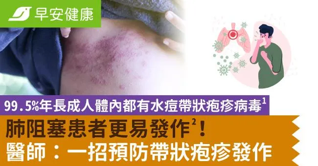 99.5％年長成人體內都有水痘帶狀疱疹病毒，肺阻塞患者更易發作！醫師：一招預防帶狀疱疹發作