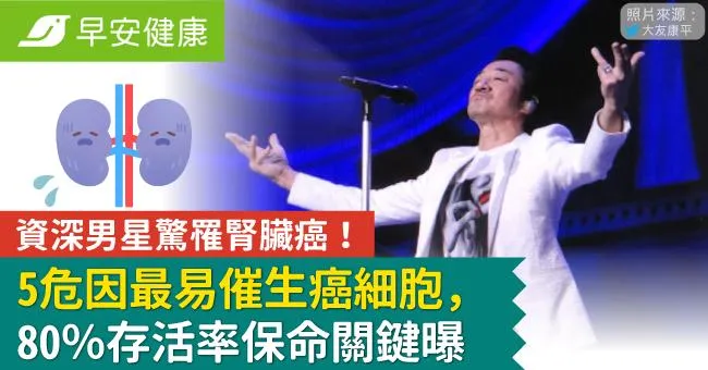 資深男星驚罹腎臟癌！5危因最易催生癌細胞，80％存活率保命關鍵曝