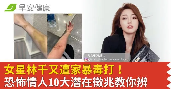 女星林千又遭家暴毒打！恐怖情人10大潛在徵兆...律師教你辨警訊